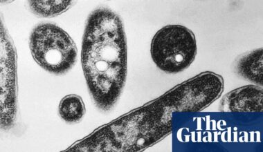 Legionnaires’ disease outbreak kills one and infects others in the South Bronx | New York