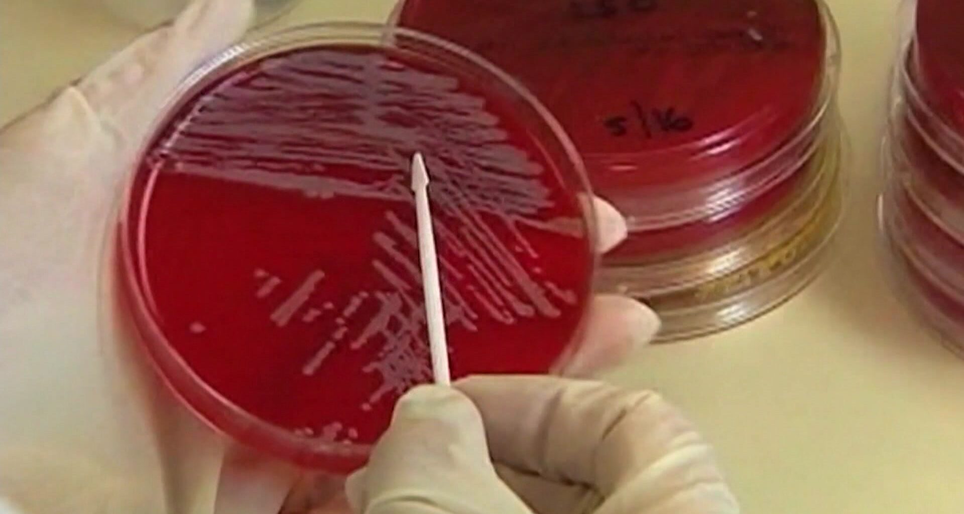 News 12 | Connecticut | Legionnaires Cluster Reported In The South Bronx 1 Dead 5 Others Diagnosed