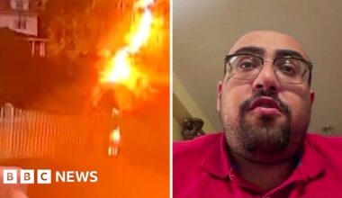 Watch: US man struck by lightning describes 'horrific' experience