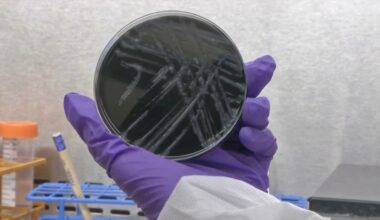 Legionnaires' disease