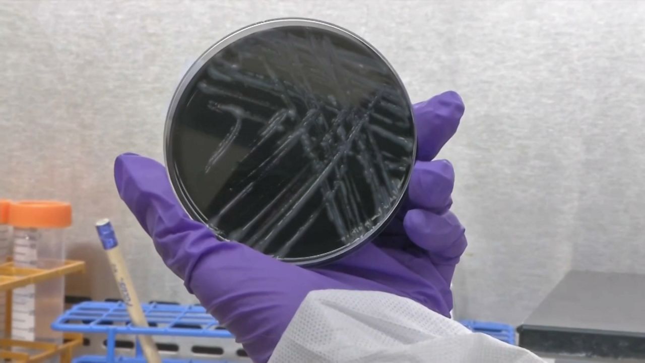 Legionnaires' disease