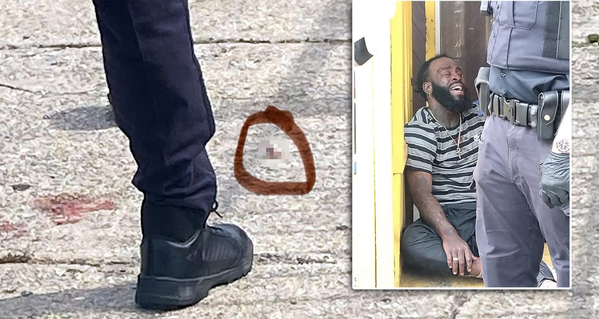 Man has eye gouged out during wild clash on Brooklyn street