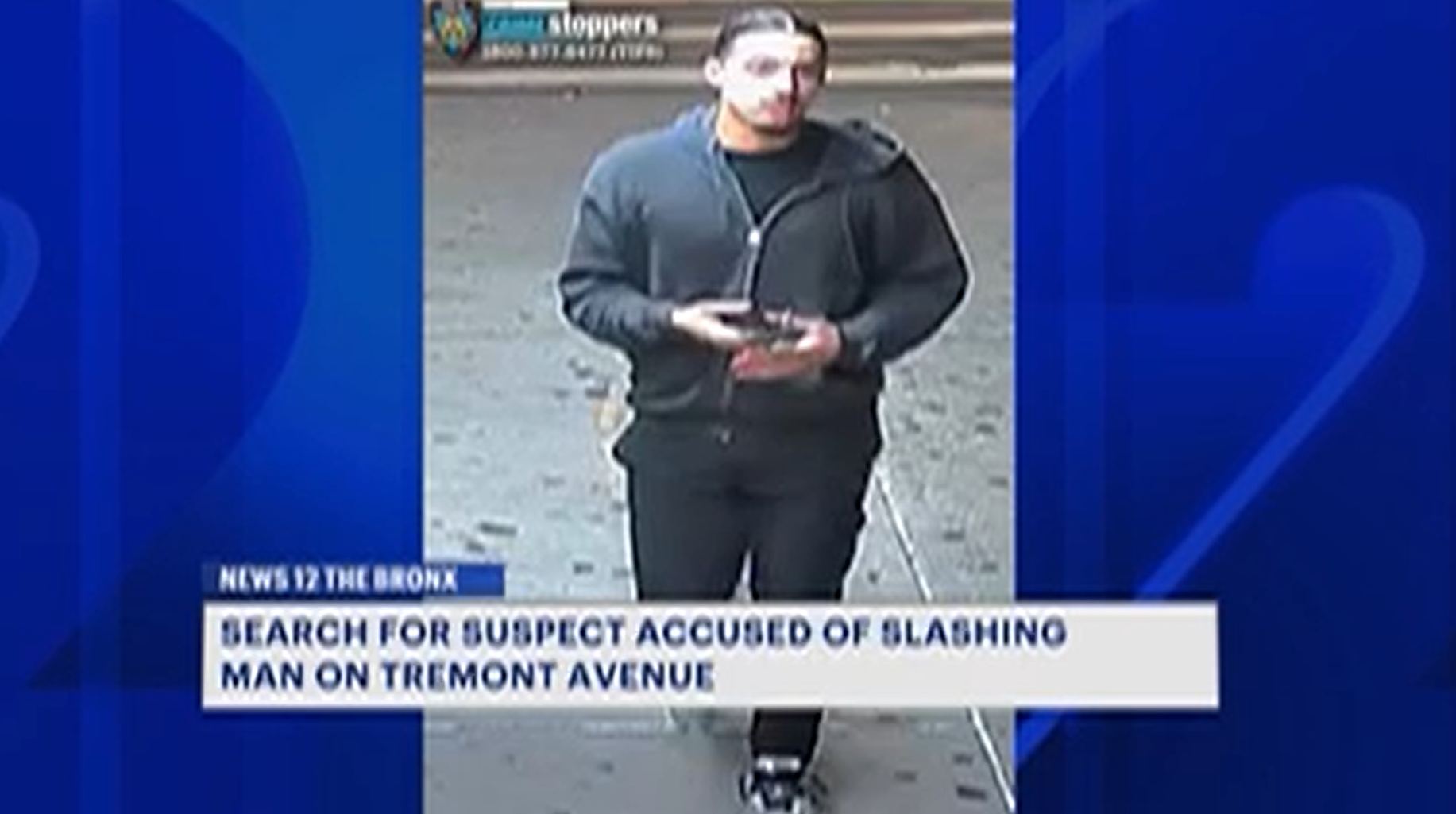 News 12 | Bronx | Man Slashed In The Face In East Tremont
