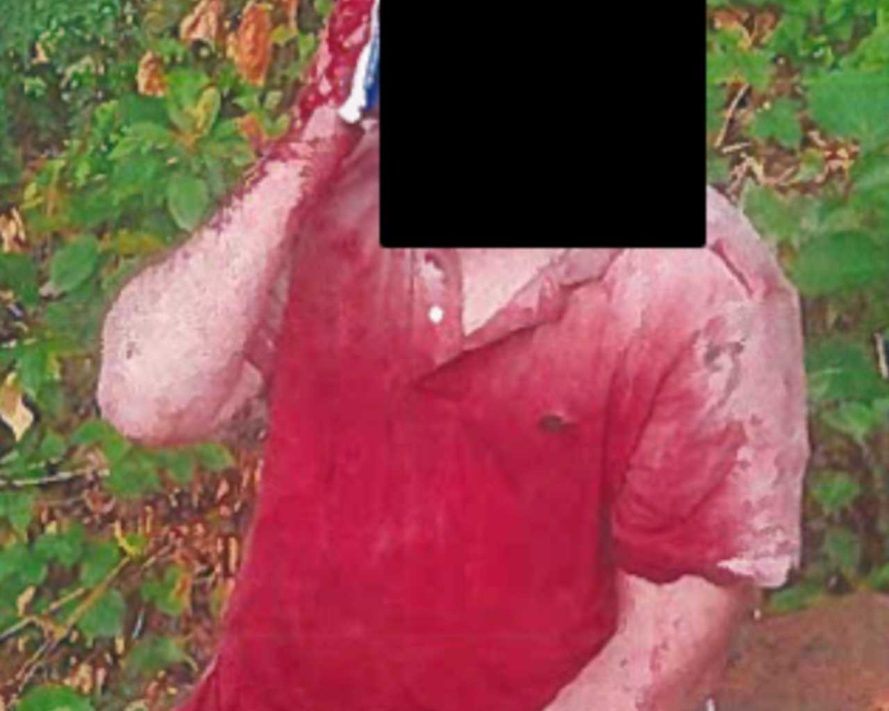 Bloodied Manhattan Kidnapping Victim Beaten, Dumped In West Orange, Feds Say