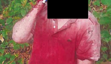Bloodied Manhattan Kidnapping Victim Beaten, Dumped In West Orange, Feds Say