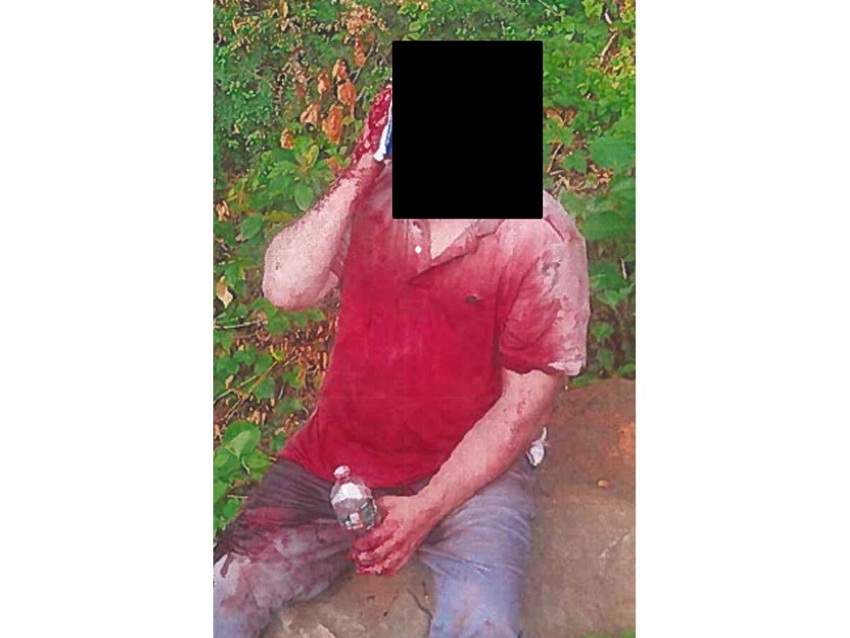 Bloody Victim Dumped In NJ After Kidnapping Outside NYC Club: Prosecutors
