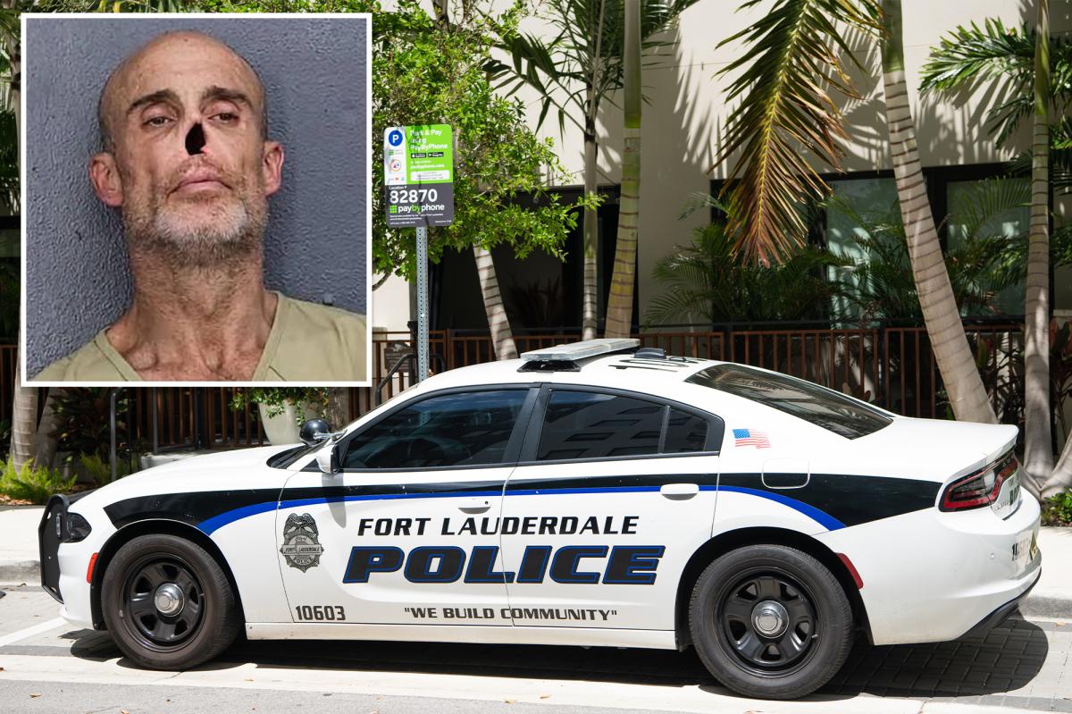 Noseless NYC man arrested on meth, cocaine charges in Florida: cops