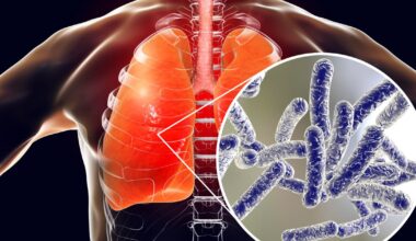 Cooling towers linked to Bronx Legionnaires' disease cluster must be cleaned by the end of Monday, NYC officials say