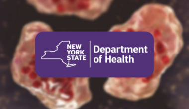 New York State Health Dept. launches measles dashboard