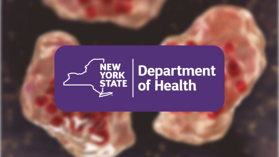 New York State Health Dept. launches measles dashboard