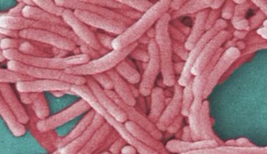 Second death in Bronx Legionnaires cluster: officials