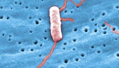 Legionnaires’ disease cluster grows in the Bronx