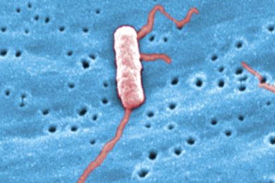 Legionnaires’ disease cluster grows in the Bronx