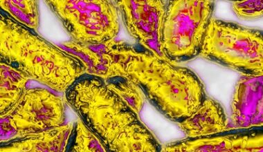 Opinion: Legionella community outbreaks are hard. Politicizing them makes them harder.