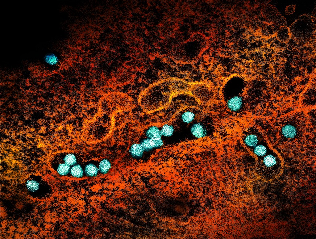 Transmission electron micrograph of West Nile virus particles (teal) replicating within the cytoplasm of an infected VERO E6 cell (brown).