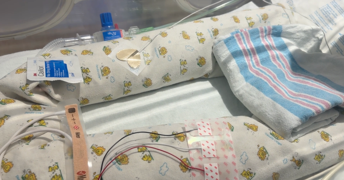 How a Brooklyn hospital is making the wait easier for NICU families