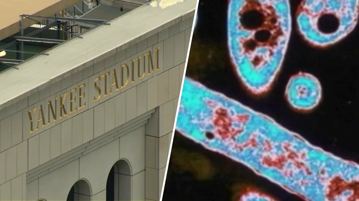 Yankees say Legionella bacteria found in stadium cooling tower not linked to outbreak – NBC New York