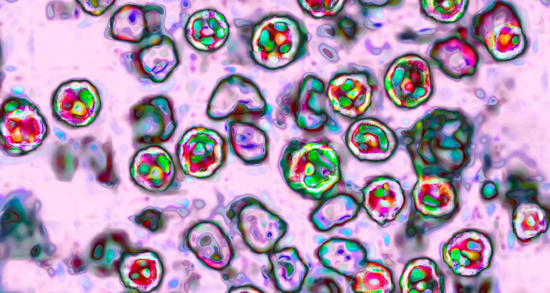 measles
