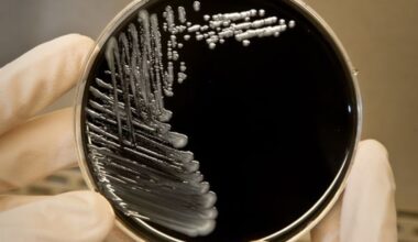 What is Legionnaires’ disease? And what constitutes an outbreak?