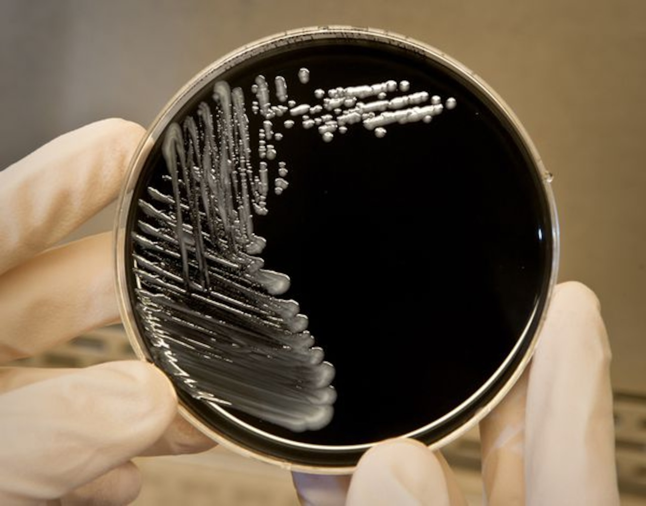 What is Legionnaires’ disease? And what constitutes an outbreak?