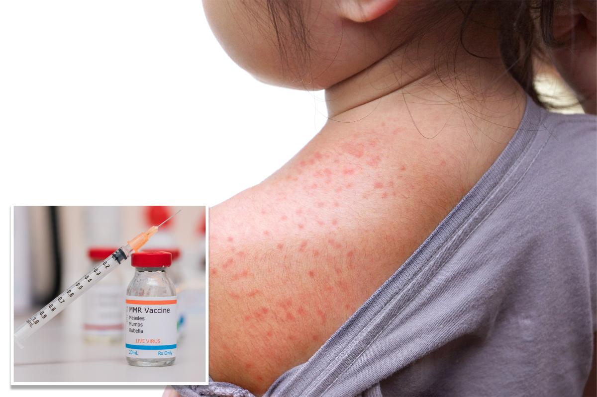 NY declares state disaster emergency over measles outbreak in rural communities
