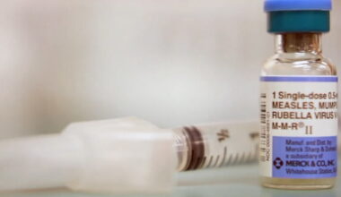 'We have to be on high alert': Measles emergency statewide