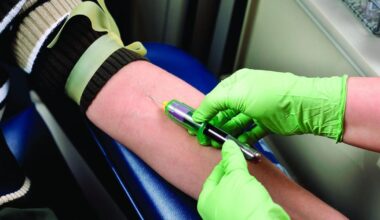 Community Blood Bank to host "Starve a Vampire, Give Blood" drive | Hometown News