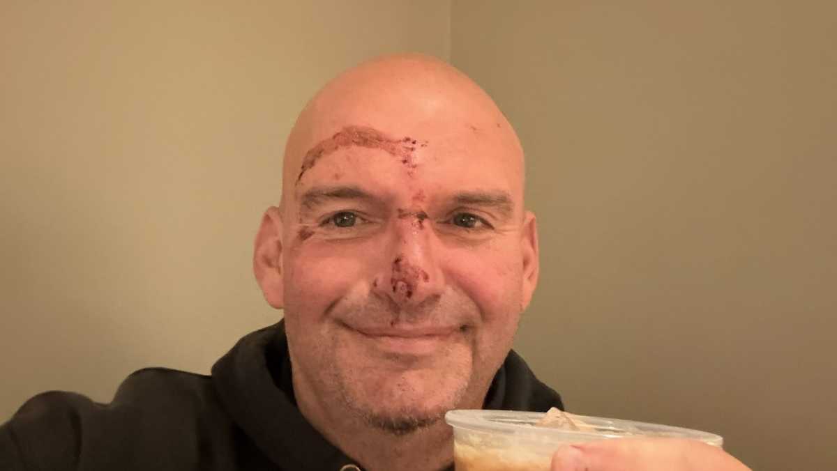 Sen. Fetterman says he is fully recovered after fall