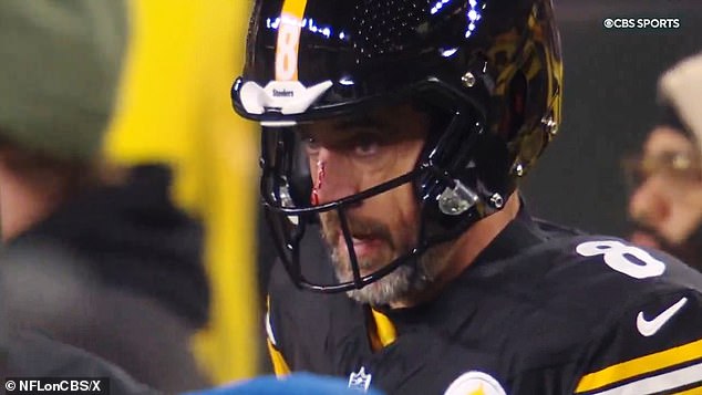 Pittsburgh Steelers quarterback Aaron Rodgers was left with a bleeding gash across his nose after taking a costly sack in the early stages of the third quarter on Sunday against Buffalo