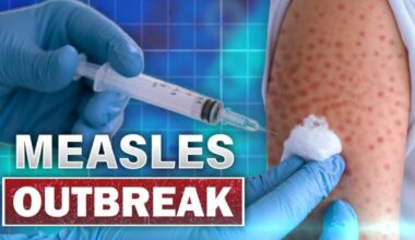 Health officials issue warning after five measles cases confirmed in Lancaster County | Berks Regional News