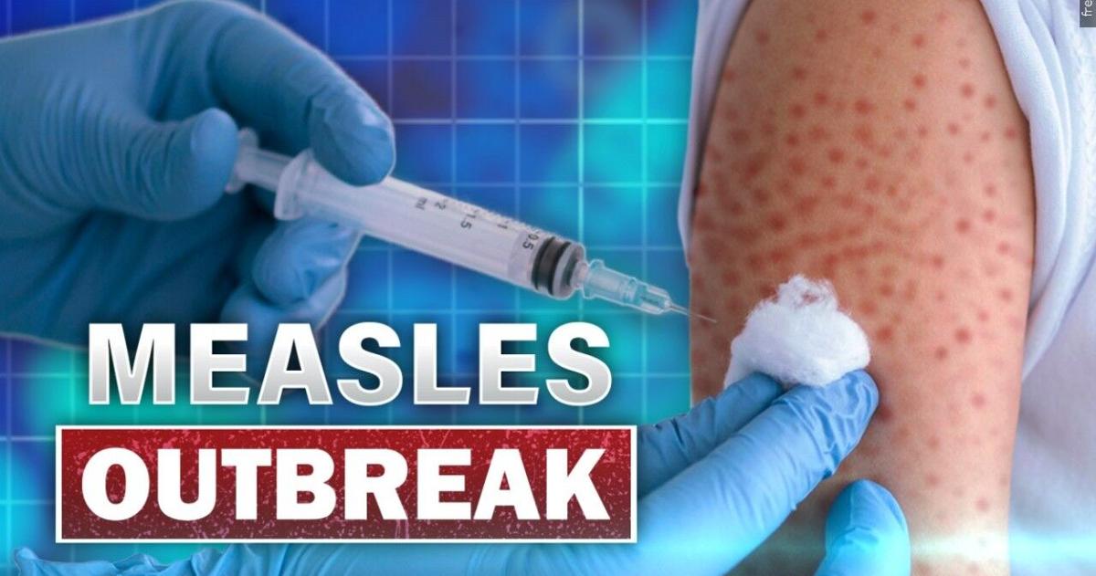 Health officials issue warning after five measles cases confirmed in Lancaster County | Berks Regional News