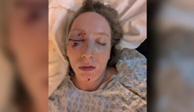 Another driver severely injured by flying ice on Pennsylvania highway | Pennsylvania News