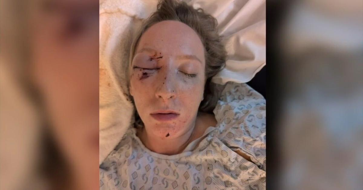 Another driver severely injured by flying ice on Pennsylvania highway | Pennsylvania News