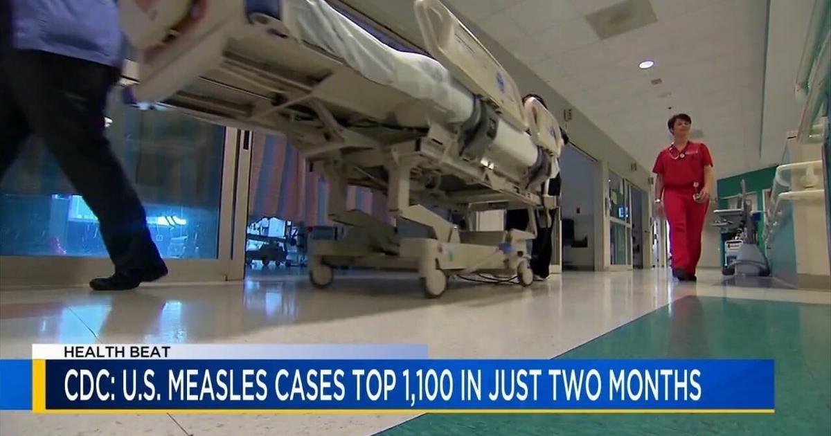 Health Beat: CDC warns about spread of measles | Health Beat