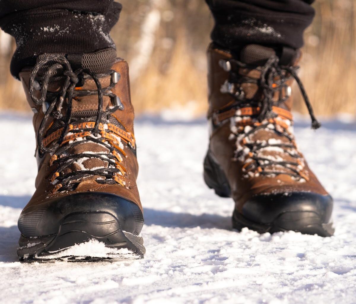 Exploding Insoles and Other Uncommon Causes of Burns