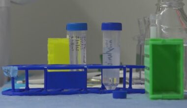 Pitt study could lead to new way to lose weight