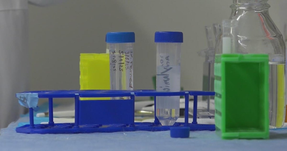 Pitt study could lead to new way to lose weight