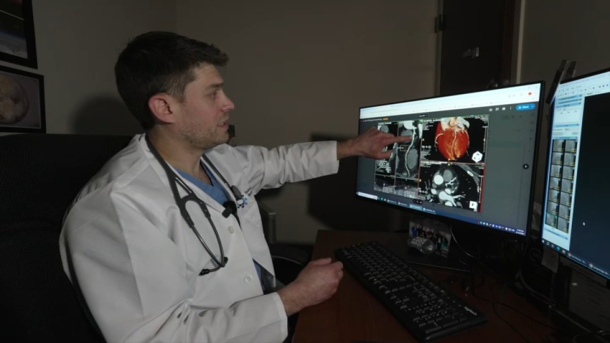 Doctors using AI for clearer picture during heart screenings – NBC10 Philadelphia
