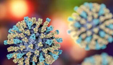 Allegheny County Health Department monitoring spread of measles across Pennsylvania – WPXI