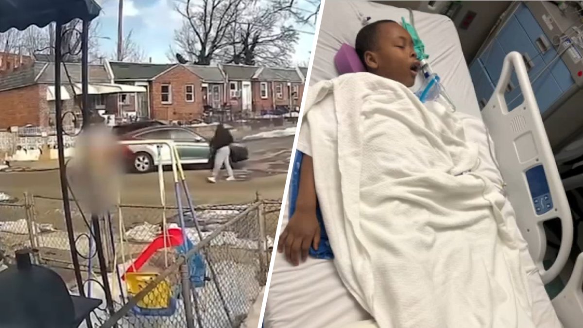 Family of 9-year-old struck by car in Philly speaks out – NBC10 Philadelphia