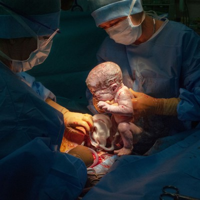 The state’s ‘maternity deserts’ are reaching a crisis point as rural hospitals continue to close childbirth services