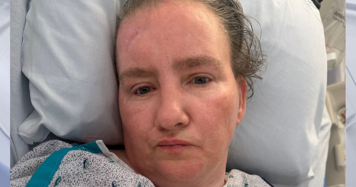 PPD look to ID woman hospitalized for 10 months after crash