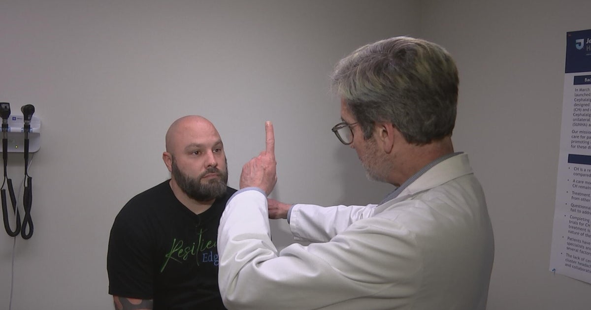 How Jefferson Health in Philadelphia is finding new ways to treat cluster headaches