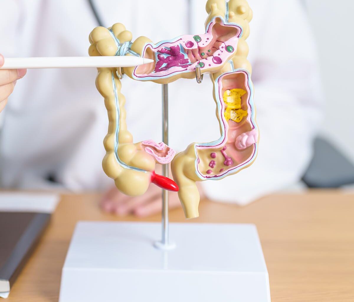 You Win When Colonoscopies Are More Convenient