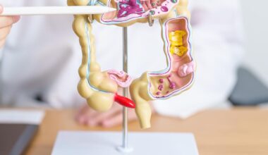 You Win When Colonoscopies Are More Convenient