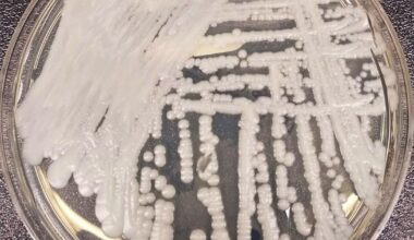 Philly health department warns of increasing cases of C. auris, a drug-resistant fungal infection