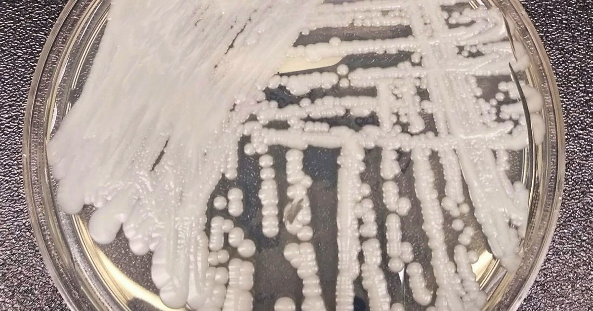 Philly health department warns of increasing cases of C. auris, a drug-resistant fungal infection