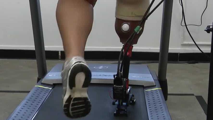 Pittsburgh company creates system to help amputees test prosthetic feet