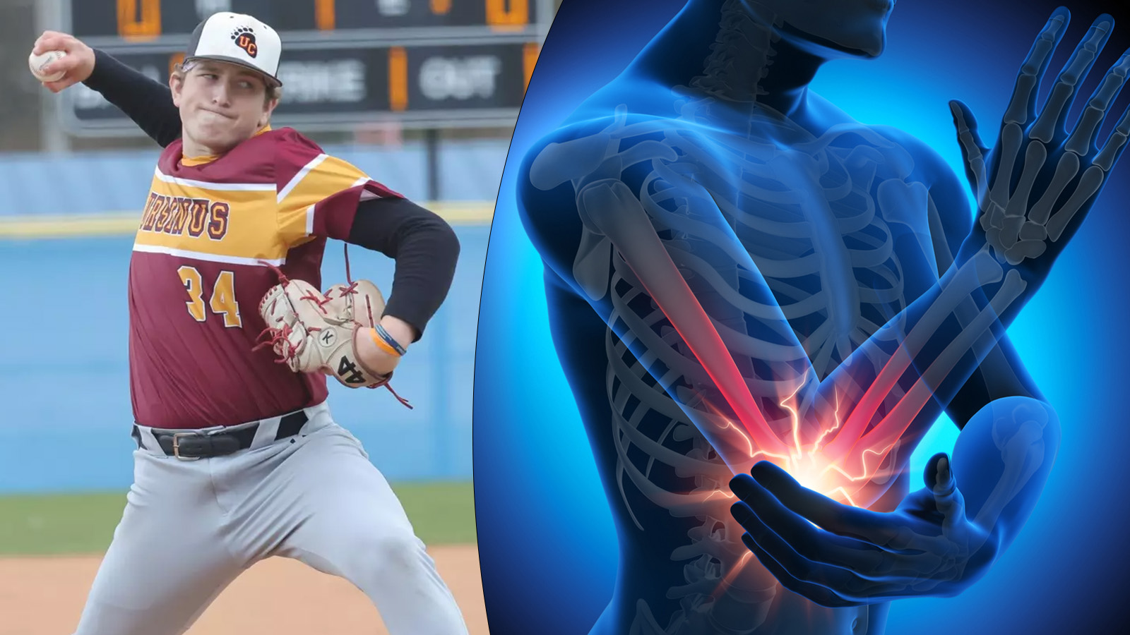 Pennsylvania Pitcher Destroys Elbow With 500 Pitches In 12 Days