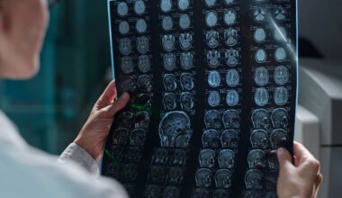 Demystifying dementia - WHYY